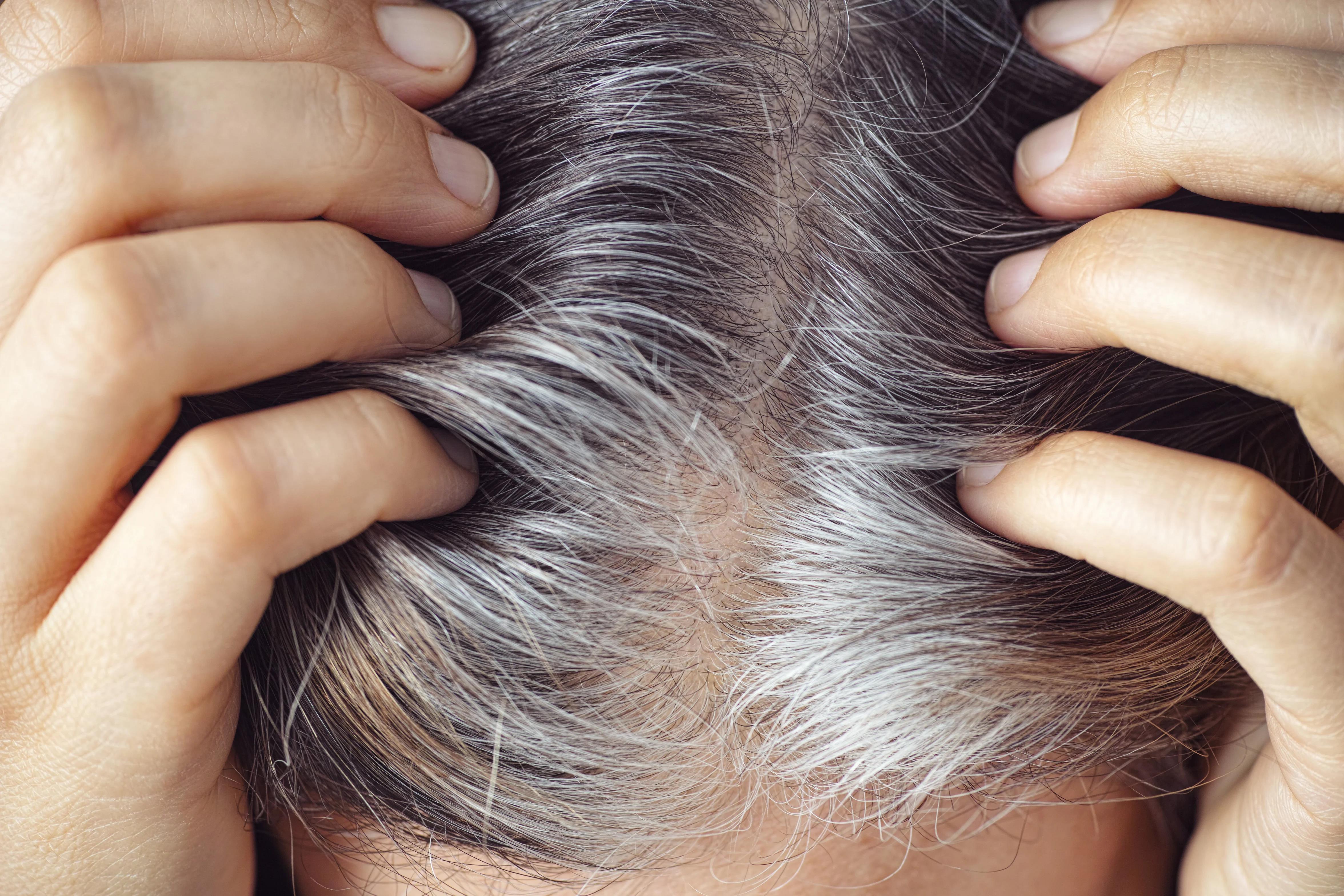 Gallbladder Meridian: Unlock the Secrets to Reducing Gray Hair and Hair Loss