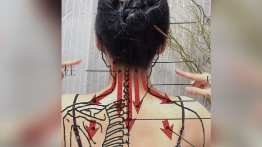 Relieving Stiff Neck and Neck Pain with Gua Sha Technique